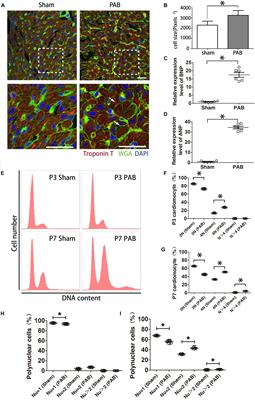 Neonatal Heart Responds to Pressure Overload With Differential Alterations in Various Cardiomyocyte Maturation Programs That Accommodate Simultaneous Hypertrophy and Hyperplasia